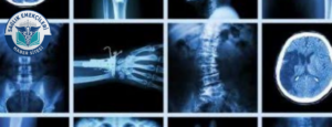 radyoloji-skandali-iddiasi-savcilik-harekete-gecti-yanlis-raporlar-mercek-altinda-saglik-emekcileri-haber-kanali-GZgP7zJd.png